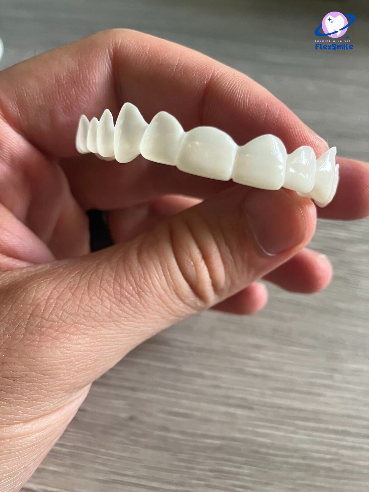 Flex-Smile® Veneers