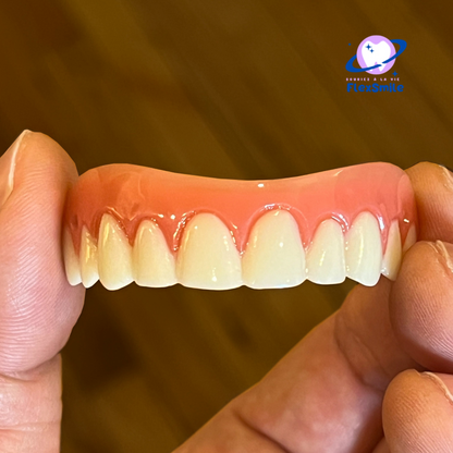 Flex-Smile® Silicone Veneers