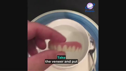 Flex-Smile® Silicone Veneers